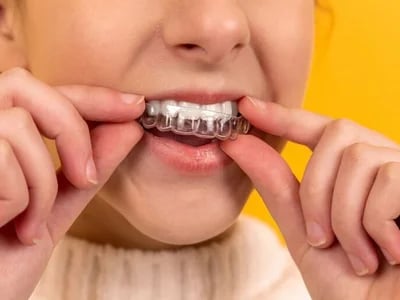 Zahnschienen und Zahngesundheit: Langfristige Vorteile