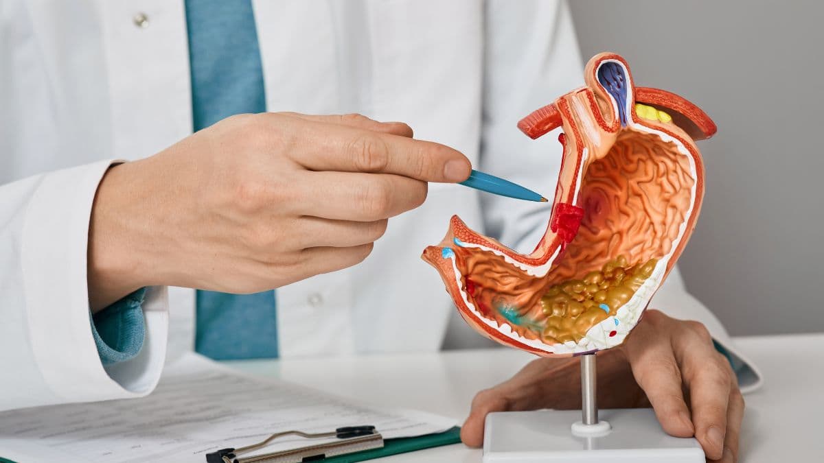 Erfahrungen mit der Magenverkleinerung Kosten: Patienten berichten über ihren Weg zum Erfolg